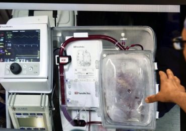 Donazione dopo morte cardiaca: organo trapiantato molte ore dopo la morte clinica grazie alla Perfusione Regionale Normotermica