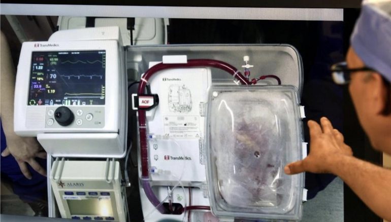 Donazione dopo morte cardiaca: organo trapiantato molte ore dopo la morte clinica grazie alla Perfusione Regionale Normotermica