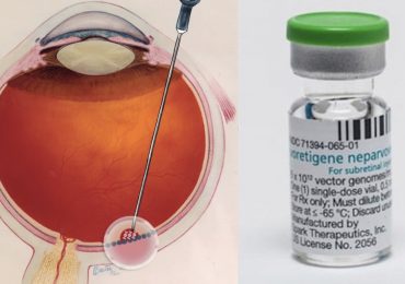 Due bambini affetti da distrofia retinica ereditaria vedono per la prima volta grazie al farmaco Luxturna 1