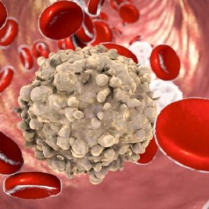 Leucemia linfatica cronica: nuovi passi avanti nella ricerca