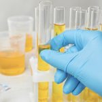 Scambiarono urine di paziente in stato di ebbrezza coinvolta in incidente stradale: medico e infermiera a processo