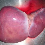 Scoperte le cellule progenitrici epatobiliari ibride: in grado di autoriparare il fegato evitando il trapianto