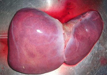 Scoperte le cellule progenitrici epatobiliari ibride: in grado di autoriparare il fegato evitando il trapianto