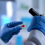 Shock nel mondo della ricerca: “Ho contratto l’Hiv in laboratorio”