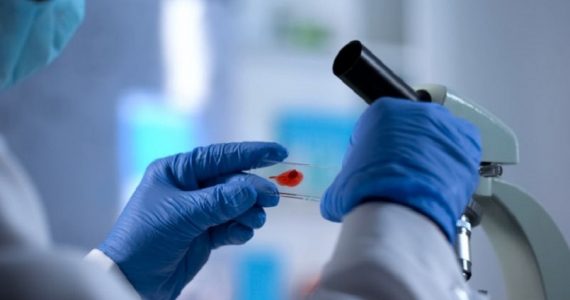 Shock nel mondo della ricerca: “Ho contratto l’Hiv in laboratorio”