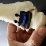 Ist. Rizzoli: ricostruita caviglia in 3D per la prima volta al mondo