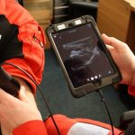 Butterfly Iq: l’ecografo portatile per iPad che rivoluzionerà il settore dell’emergenza extraospedaliera 3