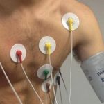 Cardiomiopatia aritmogena: scoperte cellule responsabili