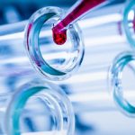 Coronavirus, si prova a mettere in cantiere un vaccino.