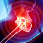 Ferrara, successo per l’impianto di una protesi realizzata “su misura” in 3D.