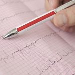 Fibrillazione atriale: diagnosi in 10 secondi grazie all’intelligenza artificiale