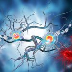 Sclerosi multipla: trapianto di cellule staminali a confronto con i migliori farmaci