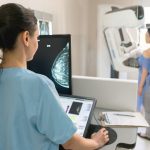 Tumore al seno, Google AI lo individua meglio dell’uomo