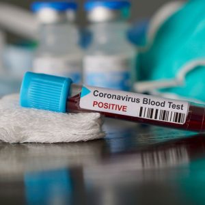Coronavirus, sedici nuovi contagiati. 2 in Veneto e 14 in Lombardia di cui 5 sono operatori sanitari. 1