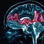 Epilessia e malattie della retina, scoperta molecola che apre la strada a trattamenti più efficaci.