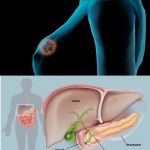 Nuovi farmaci oncologici:: Tucatinib e Olaparib