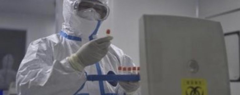 Coronavirus: ottimi risultati dall’uso off label di tocilizumab sui pazienti critici a Napoli