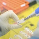 Un nuovo test rapido per diagnosticare il Coronavirus in 60 minuti brevettato dalla società italiana Diasorin