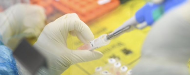 Un nuovo test rapido per diagnosticare il Coronavirus in 60 minuti brevettato dalla società italiana Diasorin