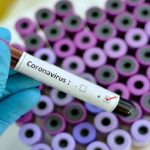 Coronavirus e ricerca degli anticorpi: importante la validazione clinica dei test.