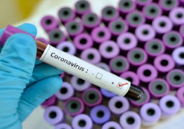 Coronavirus e ricerca degli anticorpi: importante la validazione clinica dei test.