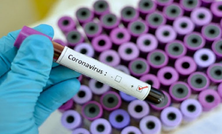 Coronavirus e ricerca degli anticorpi: importante la validazione clinica dei test.