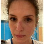 Coronavirus, il racconto di una giovane infermiera: "Le mie 5 ore nella zona gialla".