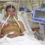 Coronavirus: in Lombardia arrivano i caschi CPAP dedicati ai contagiati per preservare posti in Terapia Intensiva