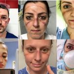 Coronavirus, infermieri Nursing Up: Il Governo stanzi risorse per chi è in trincea da oltre un mese prevedendo un risarcimento economico