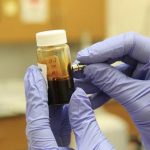 Coronavirus: l’uso offlabel di Clorochina efficace nella cura dei pazienti contagiati