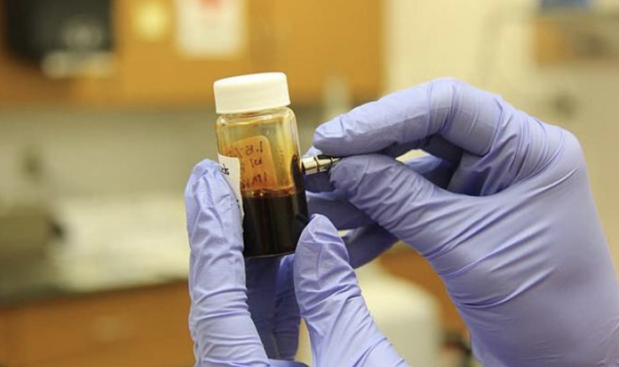 Coronavirus: l’uso offlabel di Clorochina efficace nella cura dei pazienti contagiati