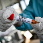 Coronavirus, bilancio per la prima volta col segno meno in Italia.