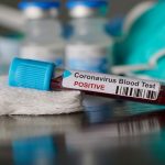 Coronavirus, festa di Pasqua a Lodi per 6 amici: uno è positivo e gli altri lo sapevano.