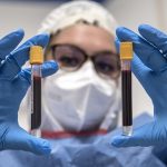 Coronavirus, pronto il test italiano per scoprire l'immunità.