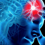Chiusura del PFO: nuove linee guida la raccomandano per prevenire nuovi ictus in pazienti under 60