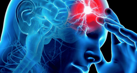 Chiusura del PFO: nuove linee guida la raccomandano per prevenire nuovi ictus in pazienti under 60