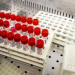 Coronavirus: un test sierologico per arginare l'infezione