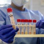 Covid-19, "Virus sopravvive nelle feci: tampone negativo non garantisce assenza di contagiosità"