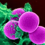 Dna modificato a globuli bianchi contro la leucemia