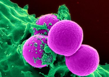 Dna modificato a globuli bianchi contro la leucemia