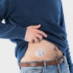 Daibete, arriva il cerotto per monitorare la glicemia