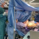 Paziente prepara 90 olive all’ascolana durante un intervento in “Awake Surgery” 1
