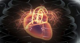 Stenosi aortica bicuspide e sostituzione della valvola transcatetere: buoni risultati con i nuovi dispositivi