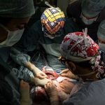 Bologna: trapianto eteropico di fegato parziale completato con successo per la prima volta al mondo