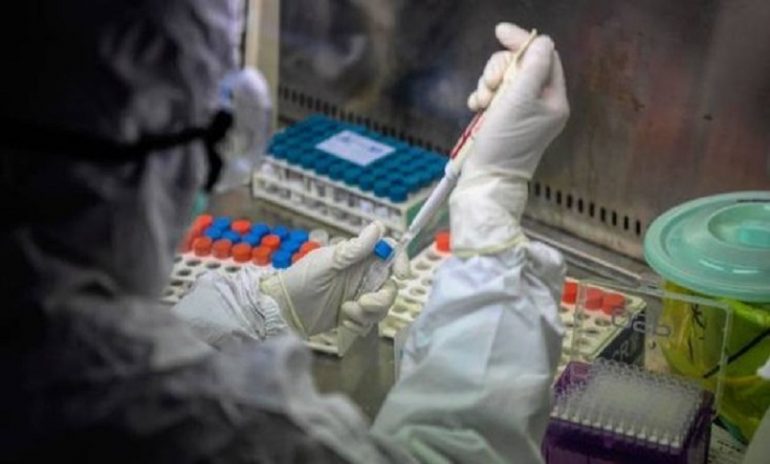 Coronavirus, da Roche la conferma: tocilizumab non migliora la salute dei pazienti