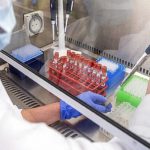 Coronavirus, ottimismo sul vaccino di Oxford: milioni di dosi in tutto il mondo se i prossimi test sono ok