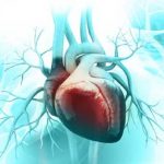 Infarto con sopraslivellamento del tratto ST: confronto di efficacia fra tre antiaggreganti piastrinici