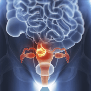 Tumore alla cervice uterina, parte dal "Gemelli" uno studio mondiale sull'immunoterapia