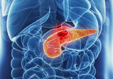 Tumore del pancreas: lo studio IEO sui benefici dell'immunoterapia
