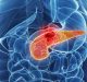 Tumore del pancreas: lo studio IEO sui benefici dell'immunoterapia